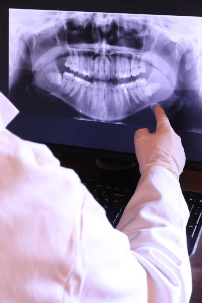 Best Emergency Treatment for Dental Infections or Abscesses in Leon Valley, TX